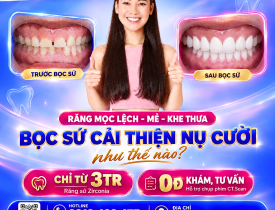 Răng mọc lệch - mẻ - khe thưa: Bọc sứ có thể cải thiện nụ cười như thế nào? 