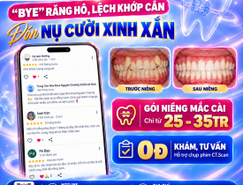 "Bye" răng hô, lệch khớp cắn - Đón nụ cười chuẩn tỷ lệ "vàng"