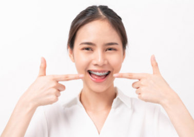 Niềng Răng – Giải Pháp Hoàn Hảo Cho Nụ Cười Tự Tin