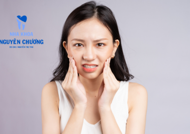 Giải mã những nguyên nhân khiến niềng răng bị hóp má