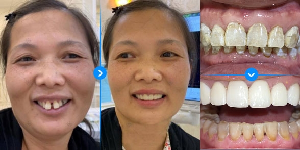 TRƯƠNG THỊ THÚY NGUYỆT